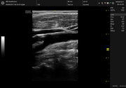 carotid.jpg