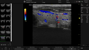 l612-thyroid-color.jpg