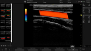 l612-vascular-carotid-color.jpg