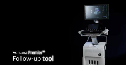 Versana Premier: Follow up tool