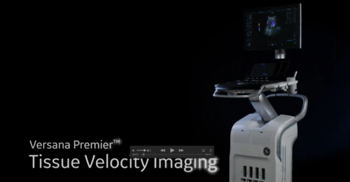 Versana Premier: Tissue velocity imaging