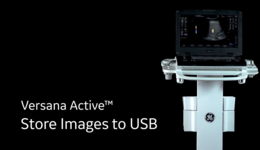 Versana Active: Store images to USB