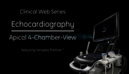 Echocardiography Apical 4-chamber view