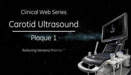 Carotid Ultrasound Plaque 1